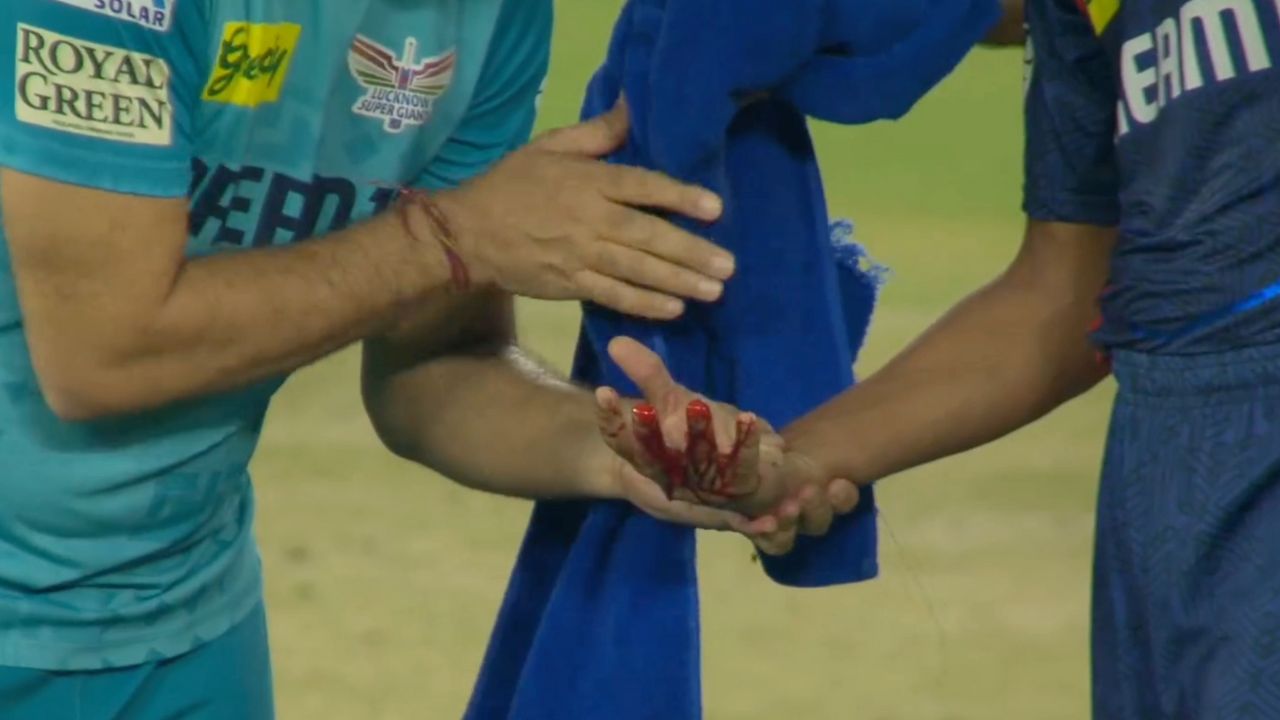 Watch- Akash Singh’s hands drenched with blood; Ugly scenes in Ahmedabad