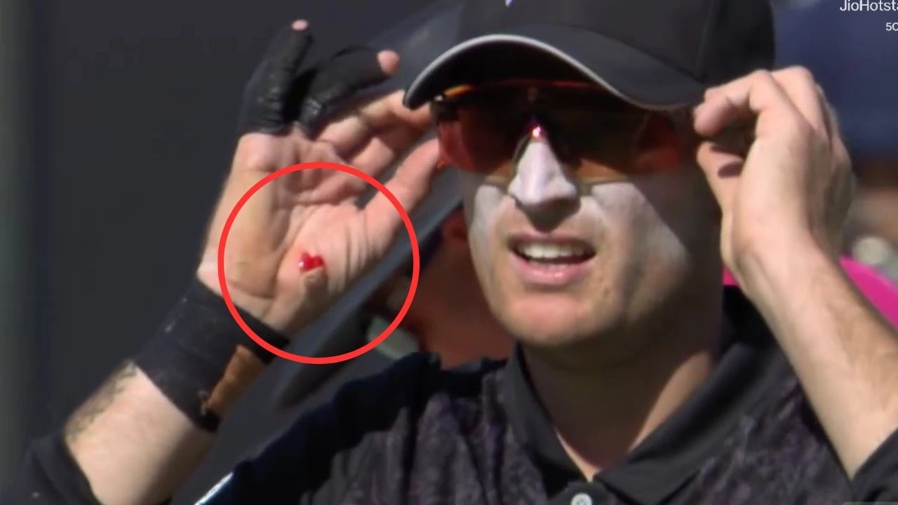 Jayden Lennox walks off BLEEDING after taking Virat Kohli’s bullet in IND vs NZ 2nd ODI